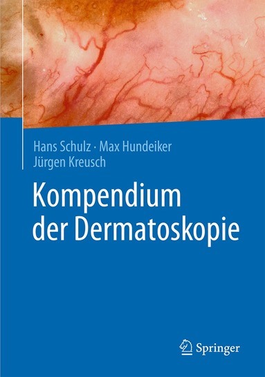 Hans Schulz, Max Hundeiker, Jürgen Kreusch - Kompendium der Dermatoskopie, Inbunden