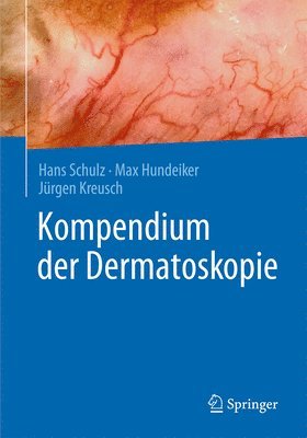 Kompendium der Dermatoskopie 1