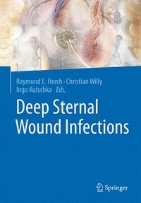 bokomslag Deep Sternal Wound Infections