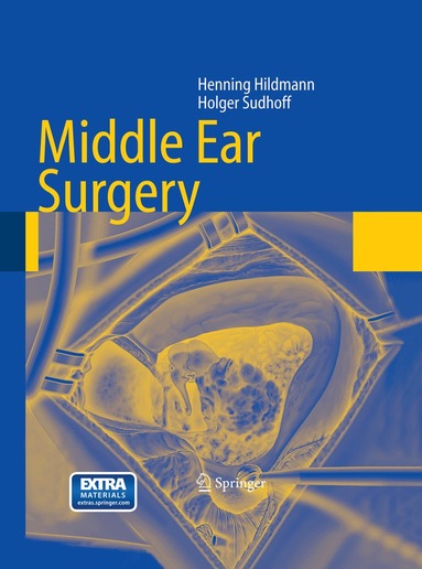 Henning Hildmann, Holger Sudhoff - Middle Ear Surgery, Häftad