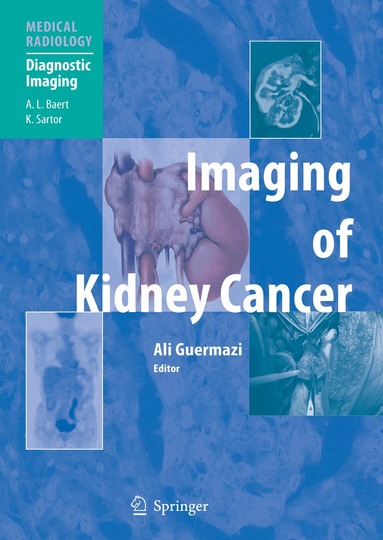 Ali Guermazi - Imaging of Kidney Cancer, Häftad