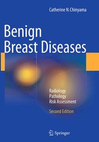 bokomslag Benign Breast Diseases