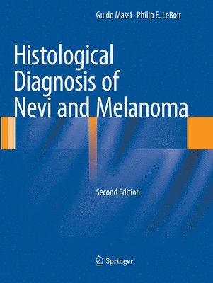 Histological Diagnosis of Nevi and Melanoma 1