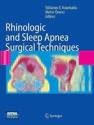 bokomslag Rhinologic and Sleep Apnea Surgical Techniques