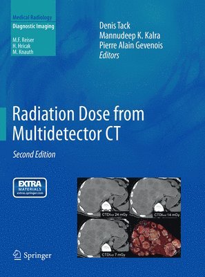 Radiation Dose from Multidetector CT 1
