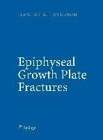 bokomslag Epiphyseal Growth Plate Fractures