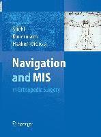 Navigation and MIS in Orthopedic Surgery 1