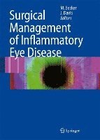 Surgical Management of Inflammatory Eye Disease 1