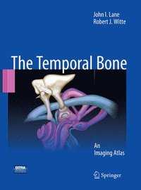 bokomslag Temporal Bone