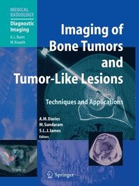 bokomslag Imaging of Bone Tumors and Tumor-Like Lesions