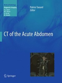 bokomslag CT of the Acute Abdomen