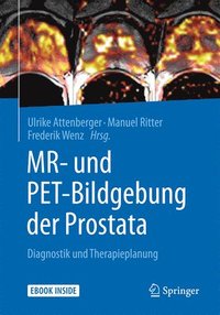 bokomslag MR- und PET-Bildgebung der Prostata