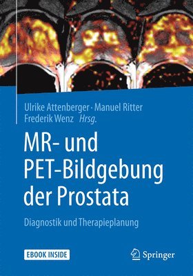 bokomslag MR- und PET-Bildgebung der Prostata