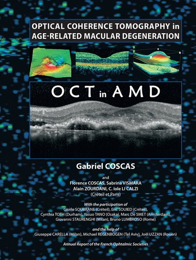Gabriel Coscas - Optical Coherence Tomography in Age-Related Macular Degeneration, Häftad