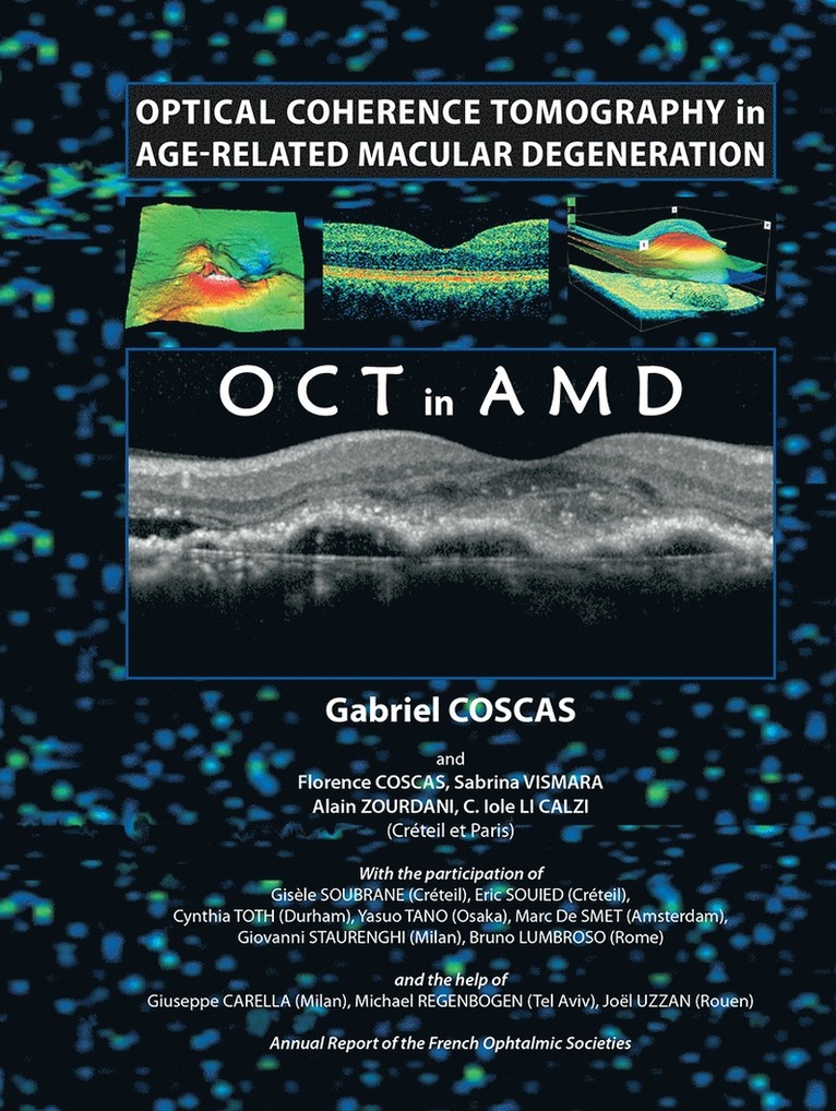 Gabriel Coscas - Optical Coherence Tomography in Age-Related Macular Degeneration, Häftad