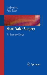 bokomslag Heart Valve Surgery