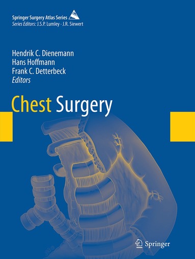 Hendrik C. Dienemann, Hans Hoffmann, Frank C. Detterbeck - Chest Surgery, Häftad