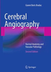bokomslag Cerebral Angiography