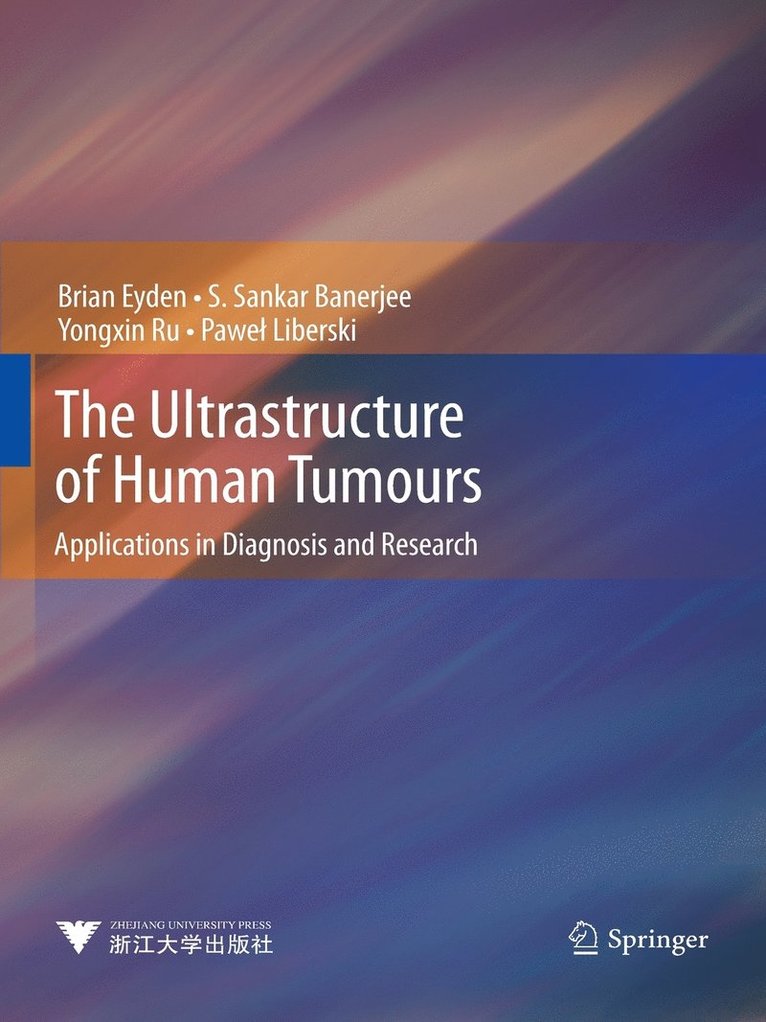 The Ultrastructure of Human Tumours 1