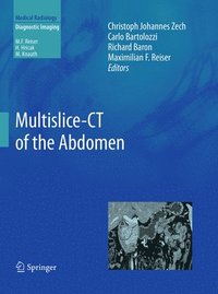 bokomslag Multislice-CT of the Abdomen