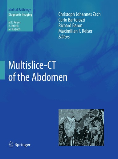 Christoph Johannes Zech, Carlo Bartolozzi, Richard Baron, Maximilian F. Reiser - Multislice-CT of the Abdomen, Häftad