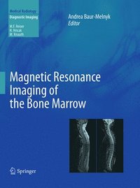 bokomslag Magnetic Resonance Imaging of the Bone Marrow