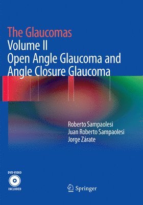 The Glaucomas 1