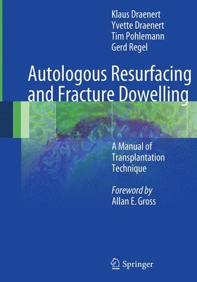 bokomslag Autologous Resurfacing and Fracture Dowelling