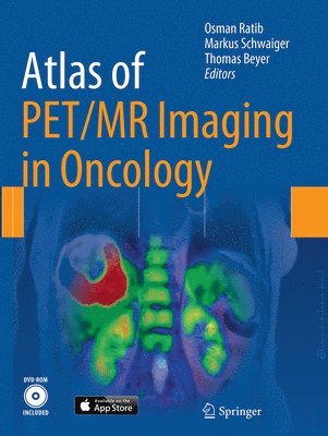 bokomslag Atlas of PET/MR Imaging in Oncology