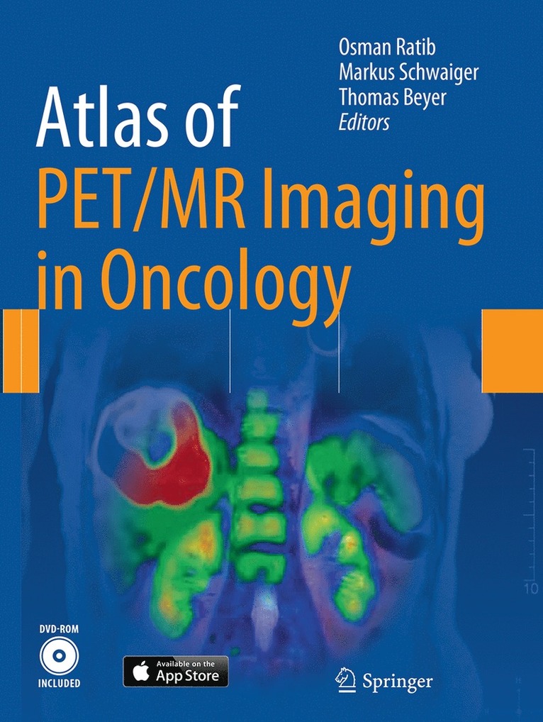 Osman Ratib, Markus Schwaiger, Thomas Beyer - Atlas of PET/MR Imaging in Oncology, Häftad