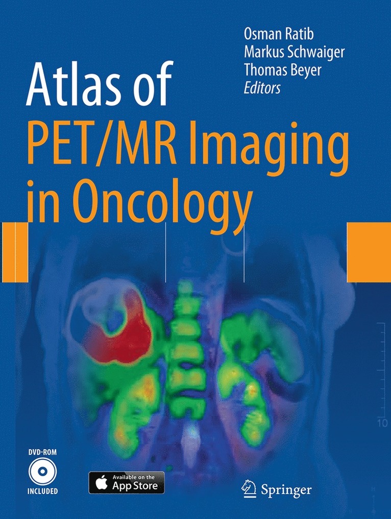 Atlas of PET/MR Imaging in Oncology 1