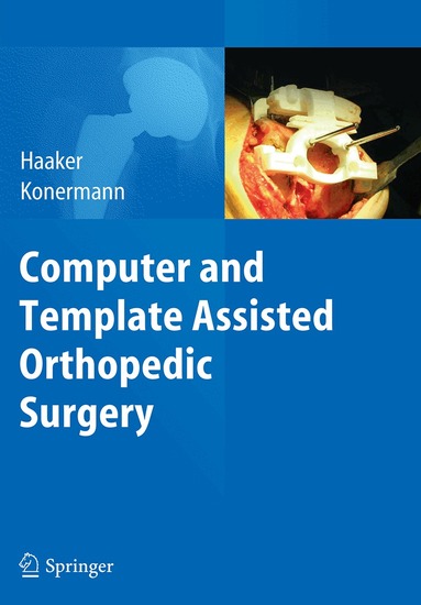 Rolf Haaker, Werner Konermann - Computer and Template Assisted Orthopedic Surgery, Häftad