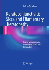bokomslag Keratoconjunctivitis Sicca and Filamentary Keratopathy