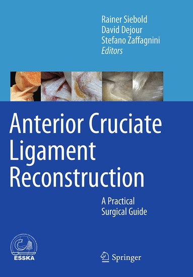 Rainer Siebold, David Dejour, Stefano Zaffagnini - Anterior Cruciate Ligament Reconstruction, Häftad