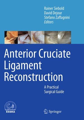 bokomslag Anterior Cruciate Ligament Reconstruction