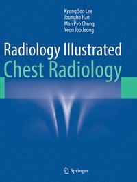 bokomslag Radiology Illustrated: Chest Radiology