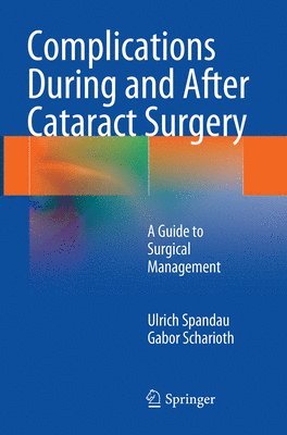 bokomslag Complications During and After Cataract Surgery