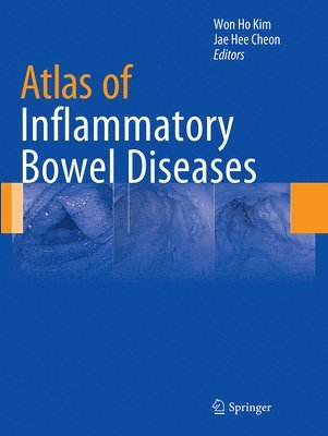 bokomslag Atlas of Inflammatory Bowel Diseases