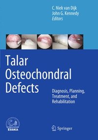 bokomslag Talar Osteochondral Defects