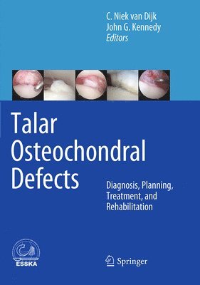 bokomslag Talar Osteochondral Defects