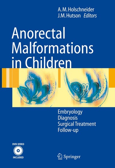 Alexander Matthias Holschneider, John M. Hutson - Anorectal Malformations in Children, Häftad