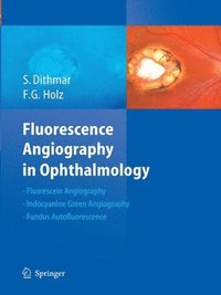 bokomslag Fluorescence Angiography in Ophthalmology