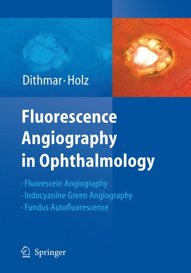 bokomslag Fluorescence Angiography in Ophthalmology