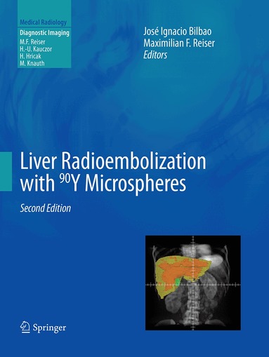 José Ignacio Bilbao, Maximilian F Reiser - Liver Radioembolization with 90Y Microspheres, Häftad