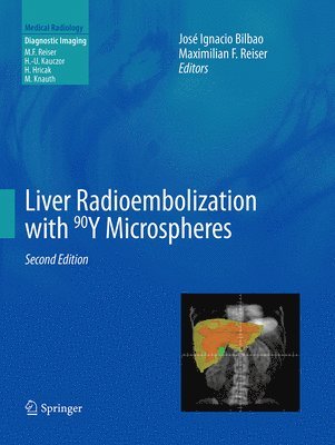 bokomslag Liver Radioembolization with 90Y Microspheres