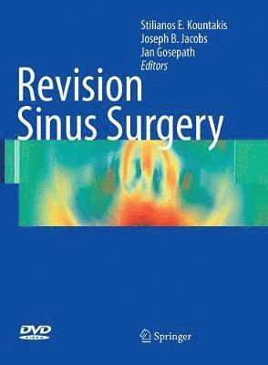 Revision Sinus Surgery 1