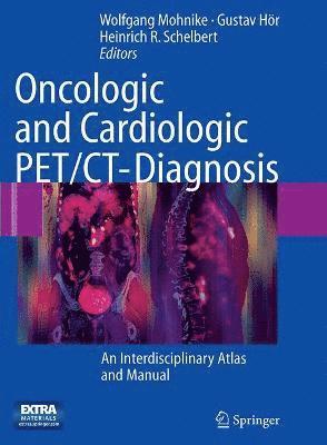 Oncologic and Cardiologic PET/CT-Diagnosis 1