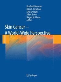 bokomslag Skin Cancer - A World-Wide Perspective