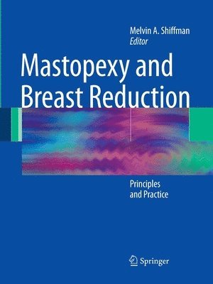 Melvin A. Shiffman, Melvin a. Shiffman - Mastopexy and Breast Reduction, Häftad