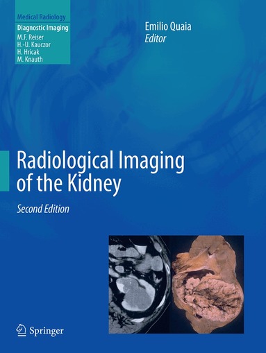 Emilio Quaia - Radiological Imaging of the Kidney, Häftad